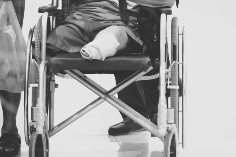 Amputation and Loss of Limb Accidents
